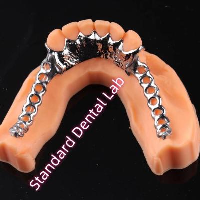 China Laser Printing Cobalt Chrome Metal Framework Partial Denture Ni Be Free for sale