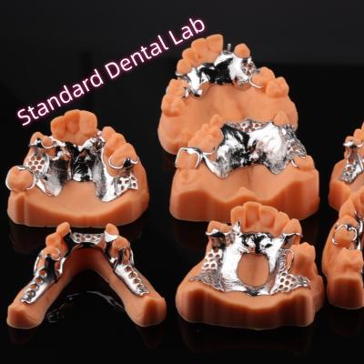 China CAD CAM Removable Partial Denture Metal Framework 3Shape Exocad Denture Design for sale