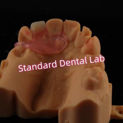 China Dentes parciales de un diente flexible extraíble en venta