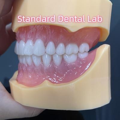 China Prótese dentária durável Dentes acrílicos de arco completo Dentes removíveis parciais à venda