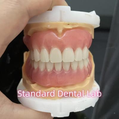 China OEM Standard Dental Lab Full Removable Dentures Easy To Take In And Out for sale