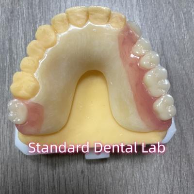 China OEM Removable Cast Tooth Shade Acrylic Partial Denture With Clasps for sale