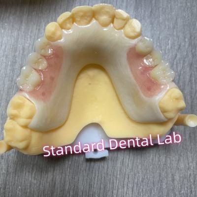 China Upper Tooth Shade Acetal Framework Acrylic Clasp Removable Partial Dentures for sale