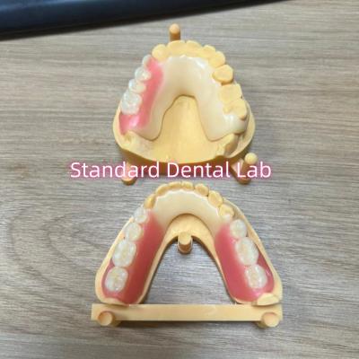 China Esthetic Tooth Shade Acetal Framework  Tooth Coloured Clasps Ivoclar Set Up for sale