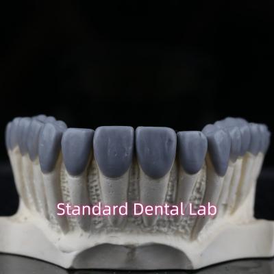 China Standard Dental Lab Dental Crown Wax Up High Esthetics for sale