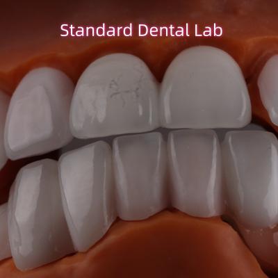 China Lithium Dicilicate layer Ivoclar Emax Zirconia Laminate Veneers Translucent OEM ODM for sale