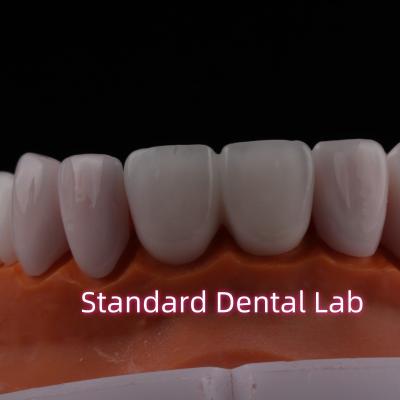 Cina Traslucide Emax Zirconia Finiture laminate Porcellana Finiture dentali Verystable chimicamente in vendita