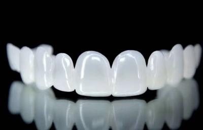 China Removable Snap On Veneers Snow White Shade Good Fit Dental Design Service for sale