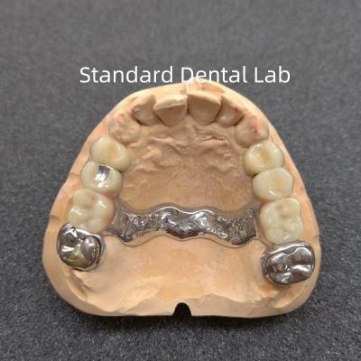 China Removable Precision Attachment Dental Partial Denture Stable Professional for sale