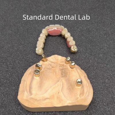 China CAD CAM Tooth Partial Denture Attachment Dental Professional Accurate for sale