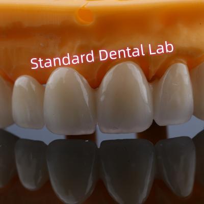 China Anterior Restoration Zirconia Bridge Crowns For Missing Teeth for sale