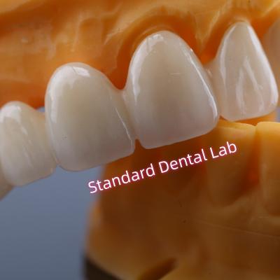 China CAD CAM Mill Zirconia Crown Bridge Highly Biocompatible for sale