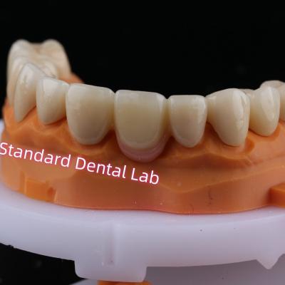 China Digital CAD CAM Milling Layered Zirconia Bridge Crown With Pink Porcelain for sale