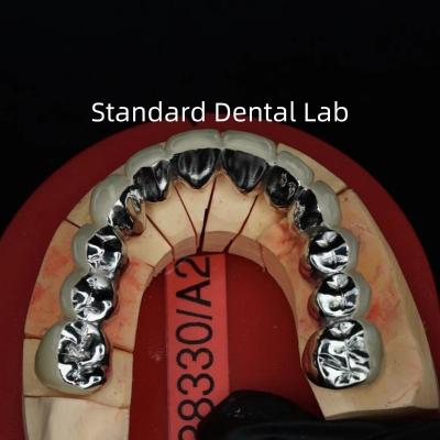 China Full Arch Metal Porcelain Crowns / Bridge Precise Esthetic PFM Crown Dental for sale