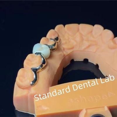 Cina Dental Teeth PFM Maryland Bridge Alta estetica Certificato FDA in vendita