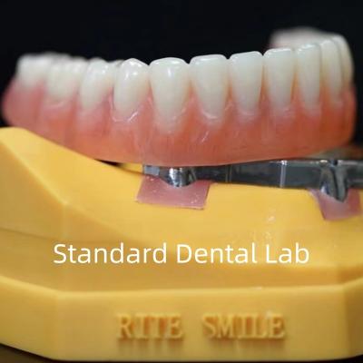 China Titanium Implant Supported Dentures Precise Ivoclar Denture Over Implants ISO FDA CE for sale