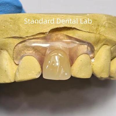 China Dental TCS Valplast Dentes parciais flexíveis Dentaduras resistentes a odores desbotantes à venda