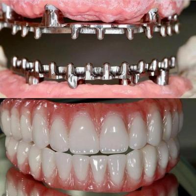 Chine Dental Hybrid Malo Implant Bridge professionnel en parfait ajustement certifié FDA à vendre