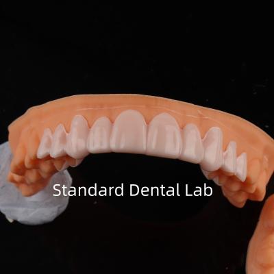 China High Esthetics Dental Snap On Smile Standard Dental Lab for sale