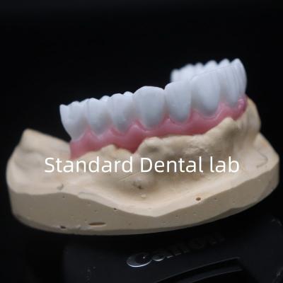 China Alta Estética Coroa Dental Branca Diagnóstico Cereja Personalizada Laboratório Dental da China à venda