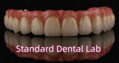 China Top manufacture in China dental implant crown zirconia crown most advanced dental lab for sale