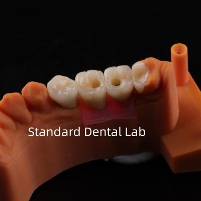 China Porcelain Zirconia Dental Implant Bridge Professional High Esthetics for sale