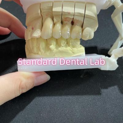 China Cast PFM Non Precious CoCr Metal Porcelain Bridge Dental CCM for sale