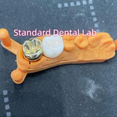 China Non Precious Yellow Metal Alloy Crown Full Cast With Zirconia Crown for sale