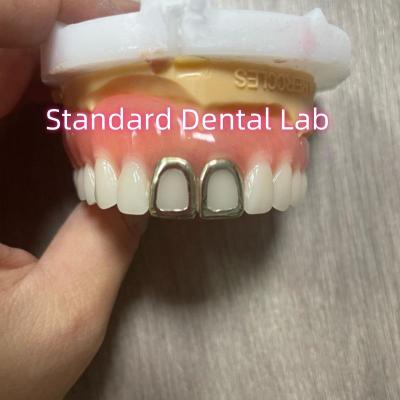 China ISO Full Acrylic Dentures With Yellow Gold Teeth Open Face for sale