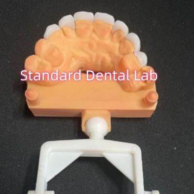 China Natürlich aussehende Laminat Zirkonia Emax Veneers Dicke 0,6 mm zu verkaufen