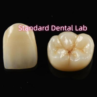 Chine Matériau biocompatible esthétique couronne de zircone de zircone dents de pont à vendre