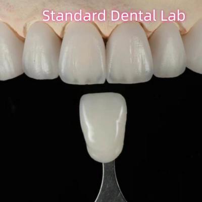 China High Aesthetic Natural Customized Aidite Zirconia Dental Bridge for sale