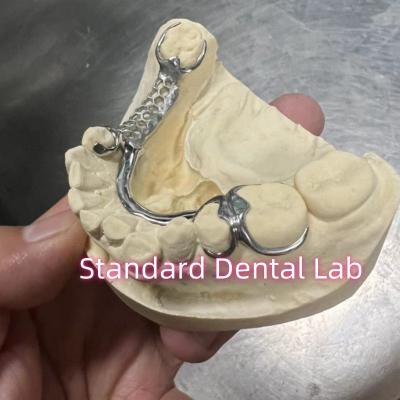 China Skelete Chrome Cast Partial Denture Metal Framework ISO for sale