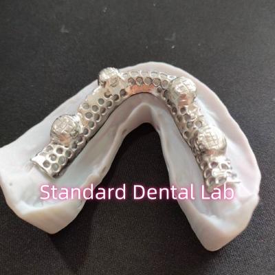 China Cast Cobalt Chrome Metal Framework Partial Denture With Metal Frame for sale