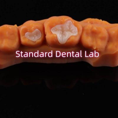 China Dental Porcelain Inlay Onlay Overlay Zirconia Emax Composite For Decay Teeth for sale