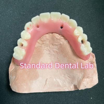 China Acrylic Partial Implant Over Denture Titianium Bar Full Denture Teeth Set Up Screw Retained for sale