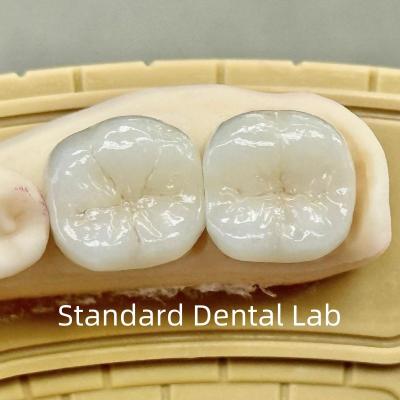 China Dental Lab Crowns Translucent Full Contour Zirconia With Superior Strength for sale