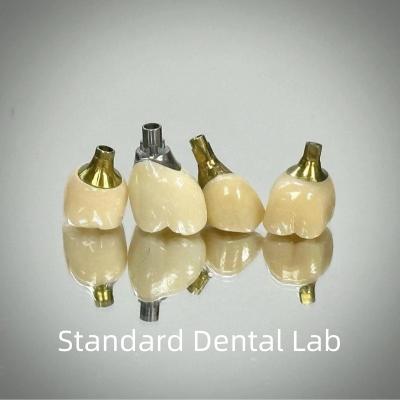 China Professional Zirconia Screw Retained Implant Crown Titanium CAD CAM for sale