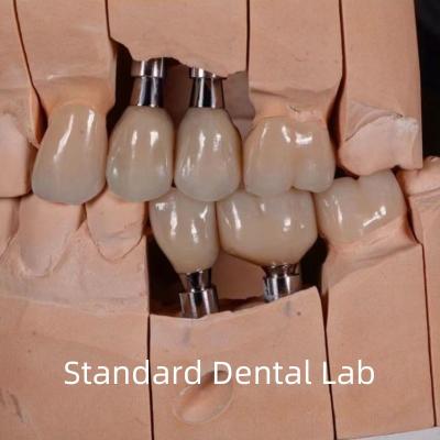 China Natural Looking Esthetic Screw Retained Zirconia Implant Crown for sale