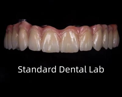 China Titanium Full Zirconia Bridge Dental Translucency On Implant Bar for sale