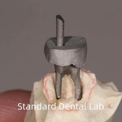 China Dental Restoration Metal Post And Core Crown Perfect Fit for sale