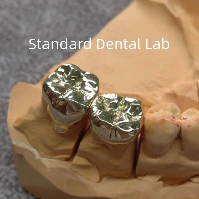 China High Nobel Yellow Dental Gold Crowns Professional Ni Be Free ISO Approved for sale