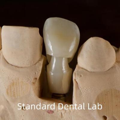 China Dental Implant Tibase Zirconia Abutment Titanium Accuracy Customized for sale