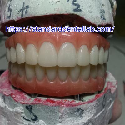 China Dental Implant Temporary Crown PMMA Bridge With Pink Porcelian for sale