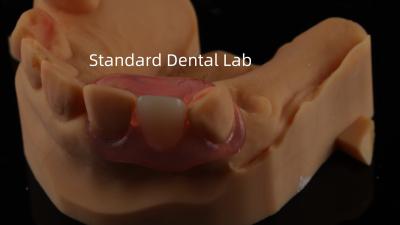 Chine Dentiste TCS Valplast Dentures partielles flexibles Nesbit Valplast Finition Chine Laboratoire dentaire Valplast Fermeture à vendre