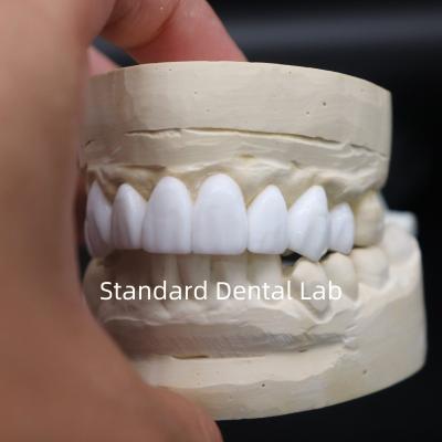 China Dental crowns diagnostic wax-up High Esthetics From China Dental Lab for sale