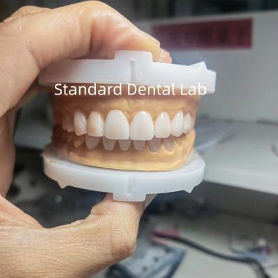 China Perfeita Estética Cera Provisória para Dentistas Profissionais Usando Cera Dental do Laboratório Dental da China à venda