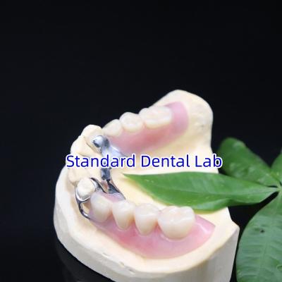 China Acrylic Metal Partial Denture Frameworks High Esthetics SDL dental lab for sale