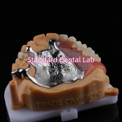 China Upper Cast Framework Acrylic Metal Partial Dentures Strong Lightweight and Durable for sale