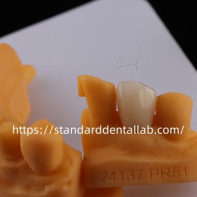 China Full Contour Dental Lab Crowns High Translucency Solid Zirconia Crown China dental lab for sale